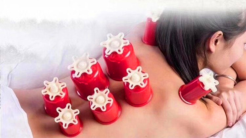 拔罐的好處以及如何正確拔罐