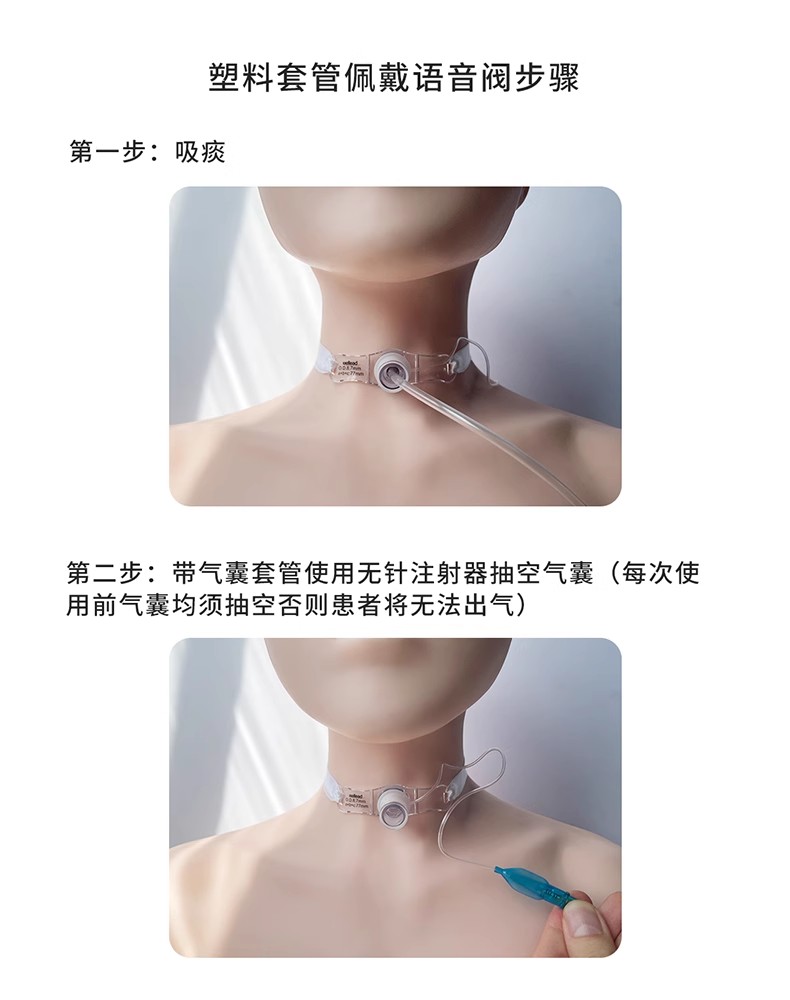 山東威陽說話瓣膜語音閥氣管插管固定器源頭生產(chǎn)廠家(圖13) 山東威陽說話瓣膜語音閥氣管插管固定器源頭生產(chǎn)廠家(圖13)