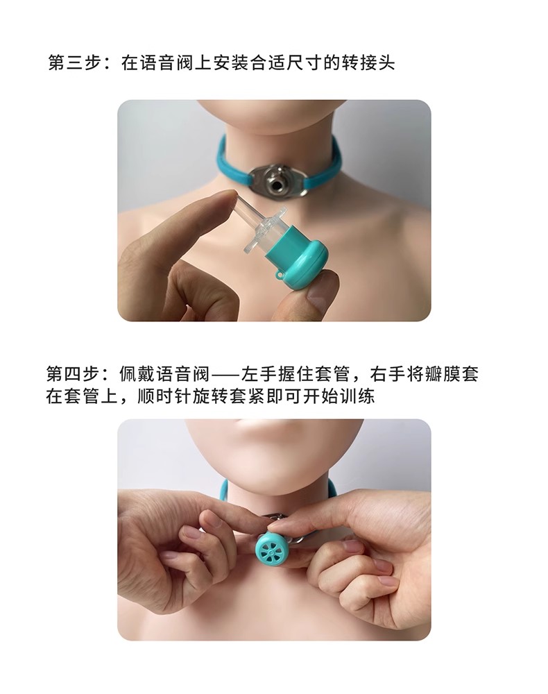 山東威陽說話瓣膜語音閥氣管插管固定器源頭生產(chǎn)廠家(圖16) 山東威陽說話瓣膜語音閥氣管插管固定器源頭生產(chǎn)廠家(圖16)